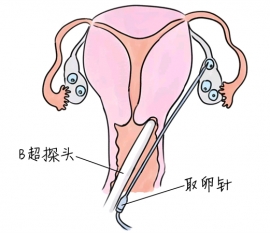 幼儿学画画，北京捐卵宝宝学画画，学画画的好处，如何学画画