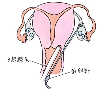 幼儿学画画，北京捐卵宝宝学画画，学画画的好处，如何学画画